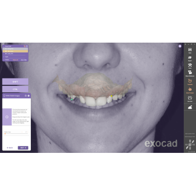 Exocad DentalCAD [Flex]