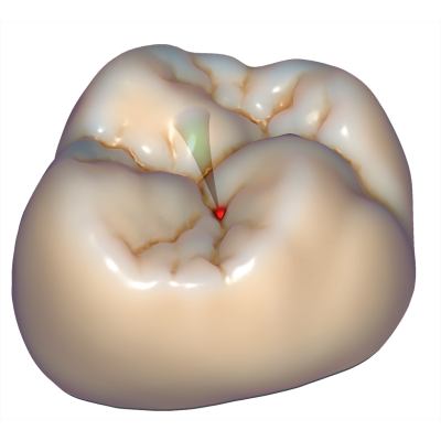 Exocad DentalCAD [Flex]