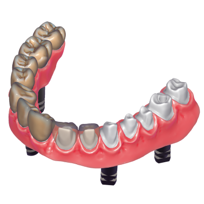 Exocad DentalCAD [Flex]