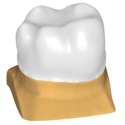 Exocad DentalCAD [Flex]