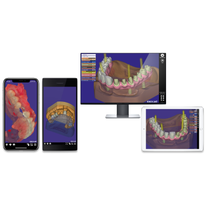 Exocad DentalCAD [Flex]