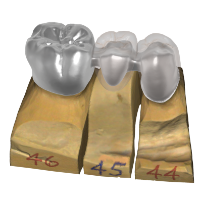 Exocad DentalCAD [Flex]