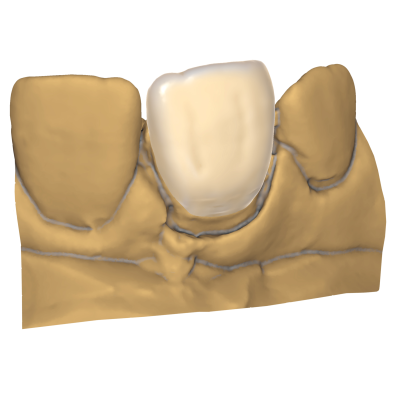 Exocad DentalCAD [Flex]