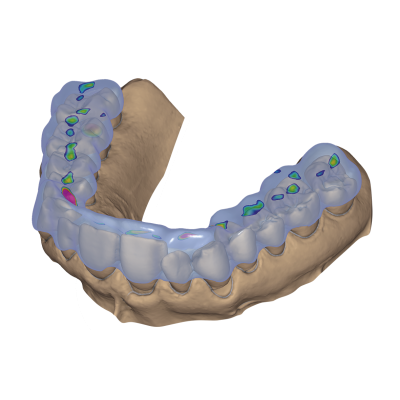 Exocad DentalCAD [Flex]