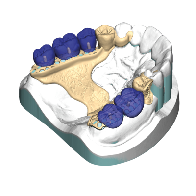 Exocad DentalCAD [Flex]