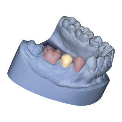 Exocad DentalCAD [Flex]