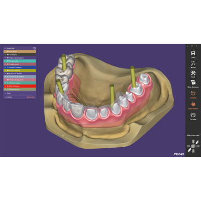 Exocad DentalCAD [Flex]