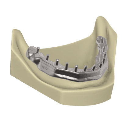 Exocad DentalCAD [Flex]