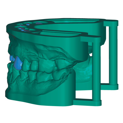 Exocad DentalCAD [Flex]