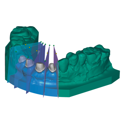 Exocad DentalCAD [Flex]