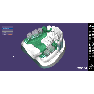 Exocad DentalCAD [Flex]