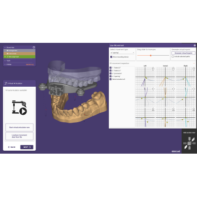 Exocad DentalCAD [Flex]